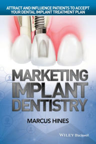 Marketing Implant Dentistry: Attract and Influence Patients to Accept Your Dental Implant Treatment Plan Marcus Hines Author